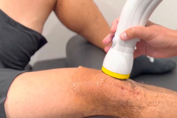 Revitalizing Knee Health: SoftWave Therapy's Breakthrough for Osteoarthritis at Smith Chiropractic